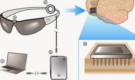 Пациентке частично вернули зрение, имплантировав бионический глаз