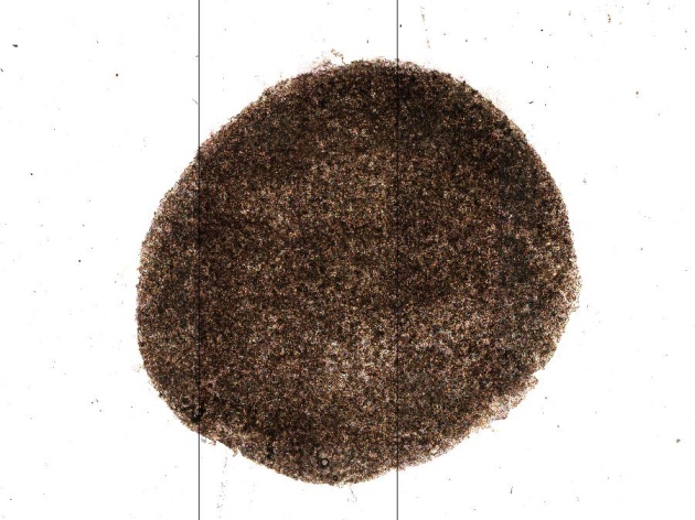 1.15915_2 RPE sheet derived from patient 1's iPS cells