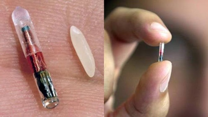 RFID - Implanted RFID Chip Under Skin (5)