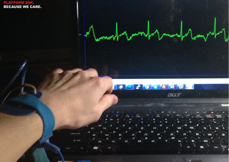 Украинская команда делает браслет, который читает ЭКГ и мониторит здоровье пользователя