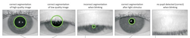 Мертвый глаз может успешно пройти сканирование радужной оболочки