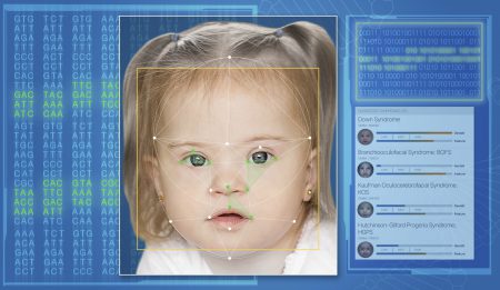 Израильские ученые представили приложение Face2Gene, способное распознать по лицу пациента редкое наследственное заболевание