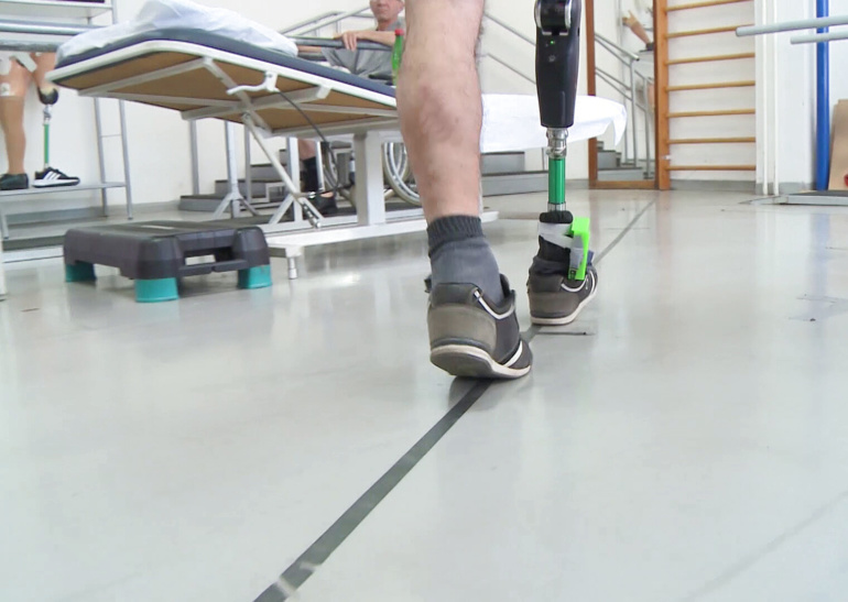 Новый нейропротез ноги воспринимается центральной нервной системой пользователя в качестве продолжения конечности
