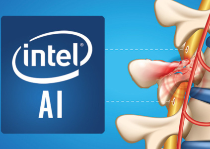Intel задействует ИИ для восстановления нейронных связей в поврежденном спинном мозге, парализованные пациенты смогут вернуть контроль над телом
