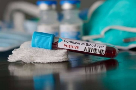 Национальная служба здоровья запустила дашборд с обновляемой в реальном времени статистикой по распространению коронавируса