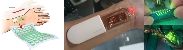 Samsung создала растягивающийся накожный дисплей OLED — его можно крепить на запястье как пластырь