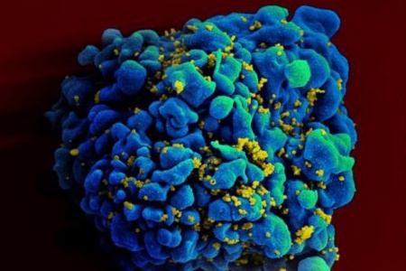 Ученые из США успешно протестировали на животных мРНК-вакцину от ВИЧ