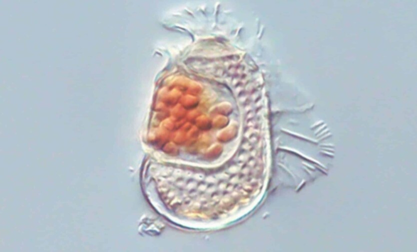Between the living and the inanimate: scientists have found a very strange bacterium