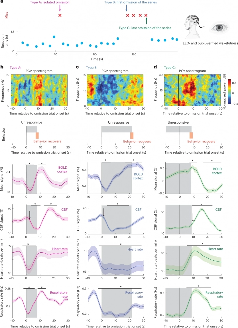 Чому мозок не може сфокусуватися, коли ви невиспані