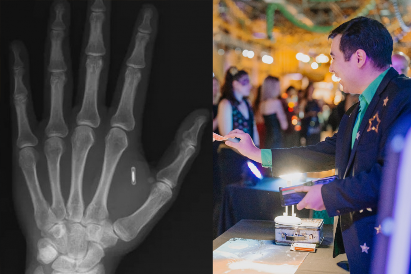 “Забув пароль від власної руки”: фокусник імплантував RFID-чип, а потім втратив до нього доступ