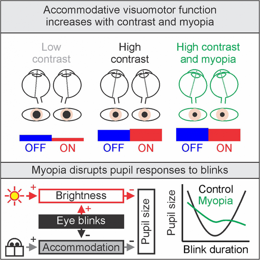 До 2050 року половина людей матиме це захворювання: винні не гаджети, а "темний" спосіб життя